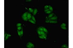 Immunofluorescence (IF) image for anti-Parvalbumin (PVALB) (AA 2-110) antibody (ABIN7162672)