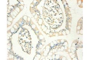Immunohistochemistry of paraffin-embedded human small intestine tissue using ABIN7159537 at dilution of 1:100 (MT1X 抗体  (AA 1-59))