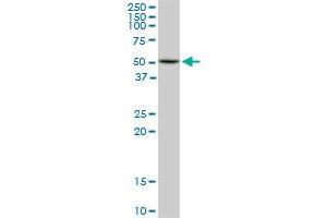 HDAC3 monoclonal antibody (M02), clone 3E11. (HDAC3 抗体  (AA 319-428))