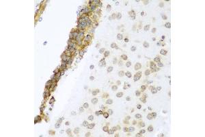 Immunohistochemistry of paraffin-embedded mouse brain using YBX1 antibody. (YBX1 抗体)