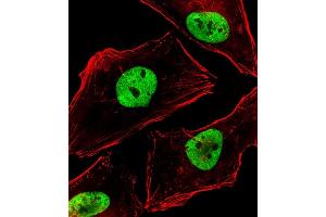 Immunofluorescent analysis of 4 % paraformaldehyde-fixed, 0. (BCL9 抗体  (AA 272-304))