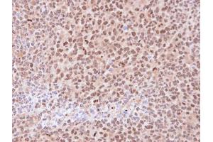 Immunohistochemistry (IHC) image for anti-Proteasome Subunit alpha 6 (PSMA6) (Center) antibody (ABIN2856913)