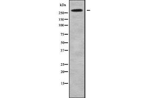 Western blot analysis NAV2 using HeLa whole cell lysates (NAV2 抗体  (Internal Region))