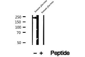 Western blot analysis of extracts of human placenta tissue, using PRPF8 antibody. (PRPF8 抗体  (C-Term))