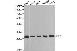 Western blot analysis of extracts of various cell lines, using EIF6 antibody. (EIF6 抗体)