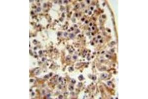 Formalin fixed and paraffin embedded testis tissue reacted with FANCC Antibody (C-term) followed by peroxidase conjugation of the secondary antibody and DAB staining. (FANCC 抗体  (C-Term))