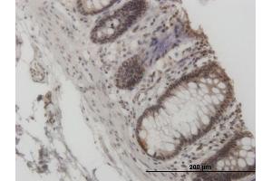 Immunoperoxidase of monoclonal antibody to GCN5L2 on formalin-fixed paraffin-embedded human colon. (KAT2A 抗体  (AA 738-837))