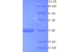 SDS-PAGE (SDS) image for Histone Deacetylase 7 (HDAC7) (AA 1-164), (partial) protein (His tag) (ABIN5713110)