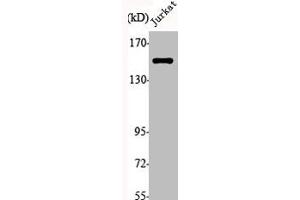 Western Blot analysis of Jurkat cells using JIP-3 Polyclonal Antibody (JIP3 抗体  (Internal Region))