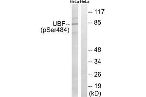 Western blot analysis of extracts from HeLa cells, treated with calyculinA (50 ng/mL, 30 mins), using UBF (Phospho-Ser484) antibody. (UBTF 抗体  (pSer484))