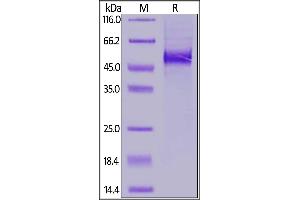 Human DLL3, His Tag on  under reducing (R) condition. (DLL3 Protein (AA 27-492) (His tag))