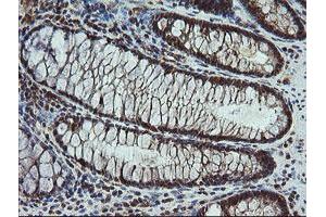 Image no. 2 for anti-Carboxypeptidase A2 (Pancreatic) (CPA2) antibody (ABIN1497598) (Carboxypeptidase A2 抗体)