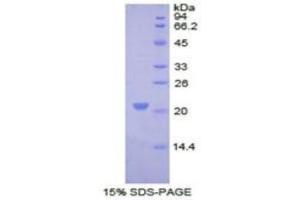SDS-PAGE of Protein Standard from the Kit  (Highly purified E. (COL8A1 ELISA 试剂盒)