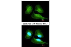 ICC/IF Image Immunofluorescence analysis of methanol-fixed HeLa, using Cullin 7, antibody at 1:200 dilution. (Cullin 7 抗体  (C-Term))