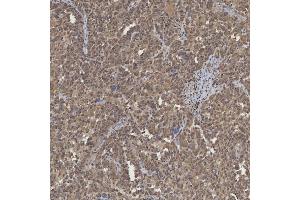 IHC analysis of mSin3A/SIN3A using anti-mSin3A/SIN3A antibody (ABIN7602504). (SIN3A 抗体  (AA 8-918))