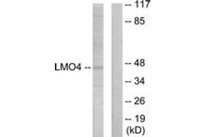 Western blot analysis of extracts from 293 cells, using LMO4 Antibody. (LMO4 抗体  (AA 116-165))
