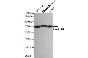 Western blot detection of Lamin B2 in HC, Mouse Embryo and Jurkat cell lysates using Lamin B2 mouse mAb(dilution 1:500). (Lamin B2 抗体)