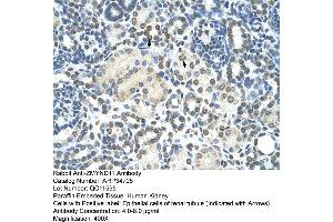 Human kidney (ZMYND11 抗体  (N-Term))
