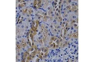 Immunohistochemistry of paraffin-embedded rat kidney using TNFRSF6B antibody at dilution of 1:200 (400x lens). (TNFRSF6B 抗体)
