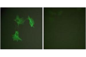 Immunofluorescence analysis of NIH-3T3 cells, using Tubulin alpha Antibody. (alpha Tubulin 抗体)