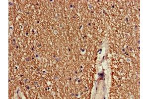 Immunohistochemistry of paraffin-embedded human brain tissue using ABIN7148482 at dilution of 1:100 (CNTNAP1 抗体  (AA 26-356))