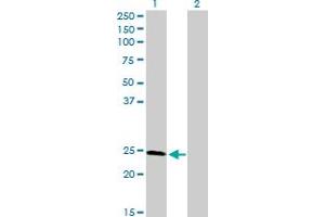 Western Blot analysis of RAD51L3 expression in transfected 293T cell line by RAD51L3 MaxPab polyclonal antibody. (RAD51D 抗体  (AA 1-216))