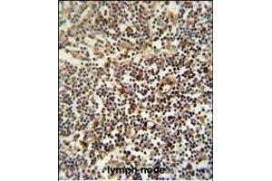 LTM5 antibody (N-term) 10077a immunohistochemistry analysis in formalin fixed and paraffin embedded human lymph node followed by peroxidase conjugation of the secondary antibody and DAB staining. (LAPTM5 抗体  (N-Term))