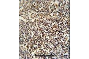 LTM5 antibody (N-term) 10077a immunohistochemistry analysis in formalin fixed and paraffin embedded human lymph node followed by peroxidase conjugation of the secondary antibody and DAB staining. (LAPTM5 抗体  (N-Term))
