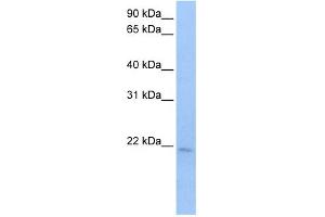 WB Suggested Anti-SPATA12 Antibody Titration:  0. (SPATA12 抗体  (N-Term))