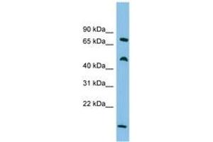 Image no. 1 for anti-Ecdysoneless Homolog (ECD) (C-Term) antibody (ABIN6744684) (ECD/SGT1 抗体  (C-Term))