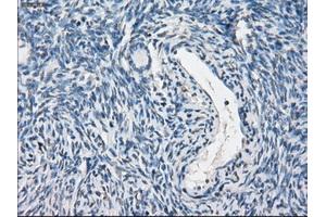 Immunohistochemical staining of paraffin-embedded colon tissue using anti-PPP5Cmouse monoclonal antibody. (PP5 抗体)