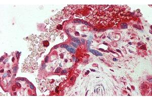 Detection of ORM2 in Human Placenta Tissue using Polyclonal Antibody to Orosomucoid 2 (ORM2) (Orosomucoid 2 抗体)