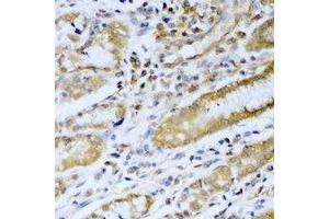 Immunohistochemical analysis of PSMB5 staining in human stomach formalin fixed paraffin embedded tissue section.