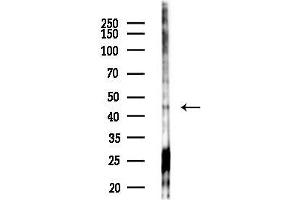 anti-Kruppel-Like Factor 13 (KLF13) (C-Term) antibody