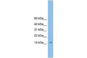 WB Suggested Anti-CHCHD1 Antibody Titration: 0. (CHCHD1 抗体  (Middle Region))