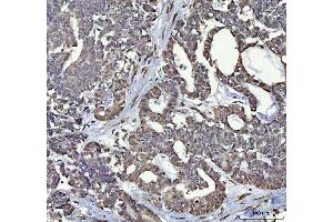 IHC analysis of RTCB using anti-RTCB antibody (ABIN7600722).