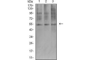 Western Blotting (WB) image for anti-AE Binding Protein 2 (AEBP2) (AA 358-495) antibody (ABIN5611314)