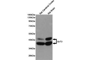 Western blot detection of SirT2 in Rat Cerebral Cortex and Rat Brain lysates using SirT2 mouse mAb (1:1000 diluted). (SIRT2 抗体)