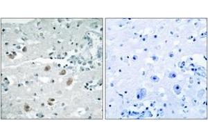 Immunohistochemistry analysis of paraffin-embedded human brain, using PLA2G4D Antibody. (PLA2G4D 抗体  (AA 531-580))