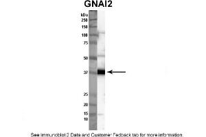 Western Blotting (WB) image for anti-Guanine Nucleotide Binding Protein (G Protein), alpha Inhibiting Activity Polypeptide 2 (GNAI2) (C-Term) antibody (ABIN2785810)