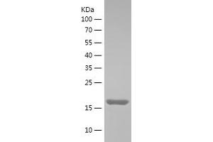 Western Blotting (WB) image for RNA Binding Motif Protein 3 (RBM3) (AA 1-157) protein (His tag) (ABIN7124923) (RBM3 Protein (AA 1-157) (His tag))