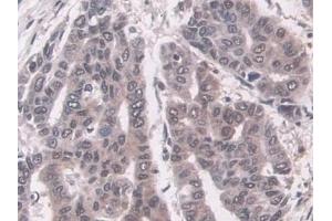 Immunohistochemistry (IHC) image for anti-Proteasome (Prosome, Macropain) Subunit, beta Type, 8 (Large Multifunctional Peptidase 7) (PSMB8) (AA 75-261) antibody (ABIN7440236)