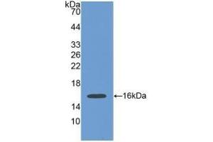 Detection of Recombinant POSTN, Human using Polyclonal Antibody to Periostin (POSTN) (Periostin 抗体  (AA 97-230))