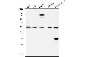 Western blot analysis of VPS4A using anti-VPS4A antibody (ABIN7599531).
