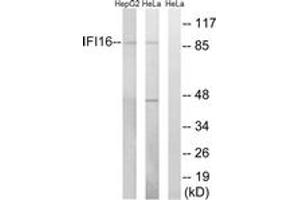 Western blot analysis of extracts from HeLa/HepG2 cells, using IFI16 Antibody. (IFI16 抗体  (AA 731-780))