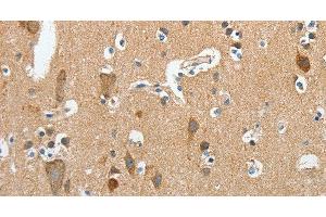 Immunohistochemistry of paraffin-embedded Human brain using DSCR1 Polyclonal Antibody at dilution of 1:45 (RCAN1 抗体)