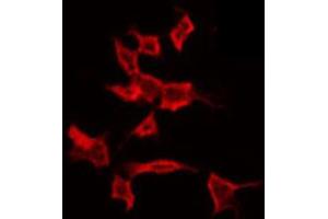 ABIN6272251 staining COLO205 by IF/ICC. (ARRDC4 抗体  (Internal Region))