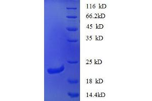 SDS-PAGE (SDS) image for Chemokine (C-X-C Motif) Ligand 16 (CXCL16) (AA 27-198), (partial) protein (His tag) (ABIN1046719)