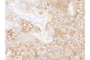 Immunohistochemistry (IHC) image for anti-Eukaryotic Translation Elongation Factor 2 (EEF2) (AA 808-858) antibody (ABIN7448956) (EEF2 抗体  (AA 808-858))