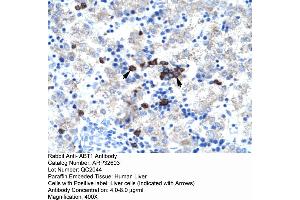 Human kidney (Activator of Basal Transcription 1 抗体  (Middle Region))